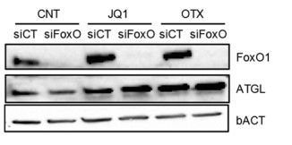 Protein expression analysis of ATGL.jpg